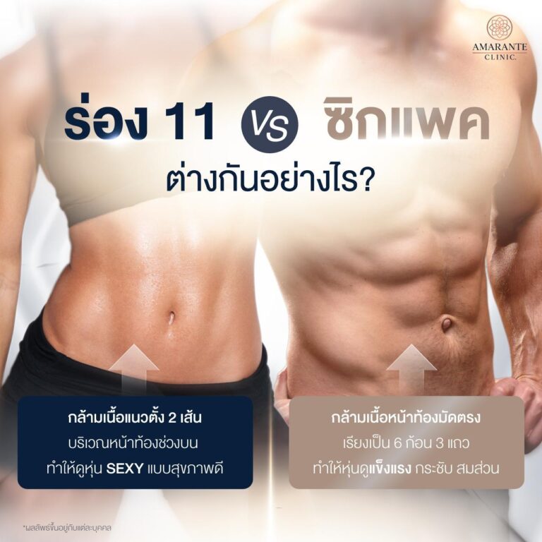 ร่อง 11 vs ซิกแพค